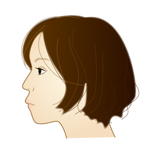 口元が突出してしまう「口ゴボ（上下顎前突）」のイラスト