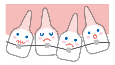 歯並びが悪いと生じるリスクとは？原因や治療方法を解説