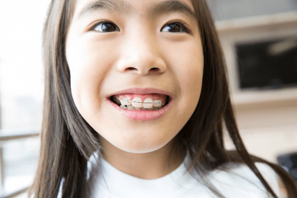矯正をする子ども
