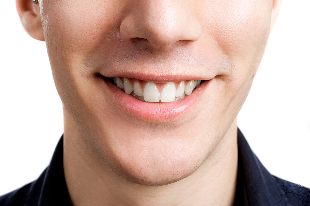 前歯だけの部分矯正はできる？矯正費用は安く、治療期間は短くなる？